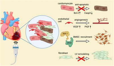 Cardiac Shockwave Therapy – A Novel Therapy for Ischemic Cardiomyopathy?